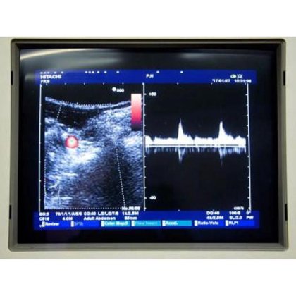 日立 EUB-6500 超音波 2 つのプローブ付き