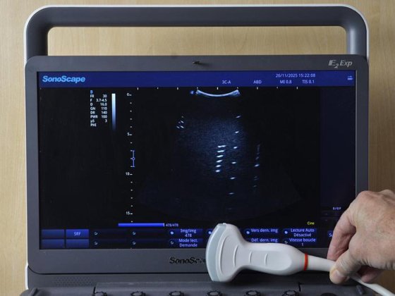 SONOSCAPE E2 Exp