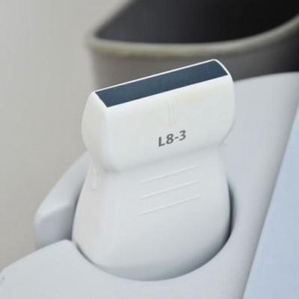 マインドレイ・ゾナレ心エコー検査者