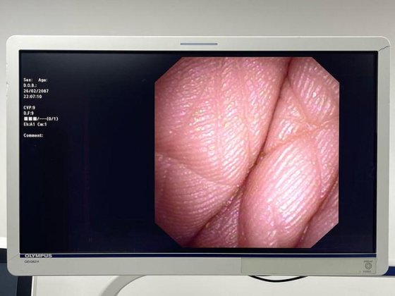 奥林巴斯瞄准镜型号：CYF-VA