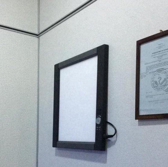 医療 X 線フィルム ビューアー ポータブル