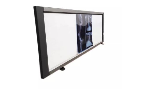 調光器とフィルム センサー、照明ビュー ボックス自動フィルム活性化医療 X 線フィルムのビュー