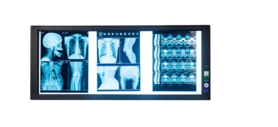 調光器とフィルム センサー、照明ビュー ボックス自動フィルム活性化医療 X 線フィルムのビュー