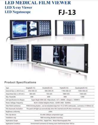 ベストセラーの医学のフィルムの視聴者のX線フィルムの観察ランプの観覧のライト箱 X線フィルムの視聴者