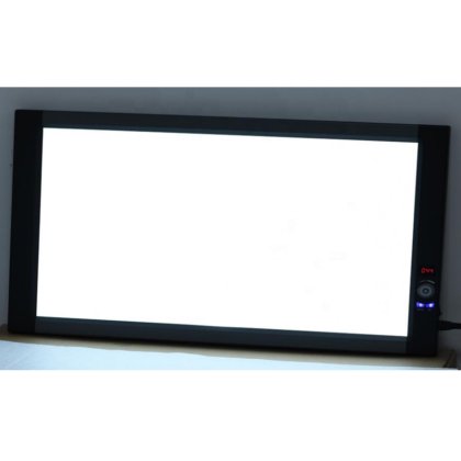 最も新しい X 線フィルムの視聴者ボックス医療ビュー ボックス新型医療 X