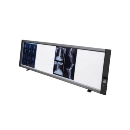 病院の医学のフィルムの視聴者デジタル表示装置の歯科否定鏡は二重 X 光線の医学のフィルムの視聴者箱を導きました