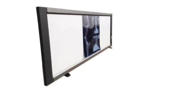 売れ筋の医学の X 線フィルムの眺め箱の医学のフィルムの視聴者のパネル箱