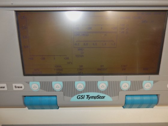 Grason-Stadler GSI Tympstar V1 Tympanometer Middle Ear Analyzer w ...