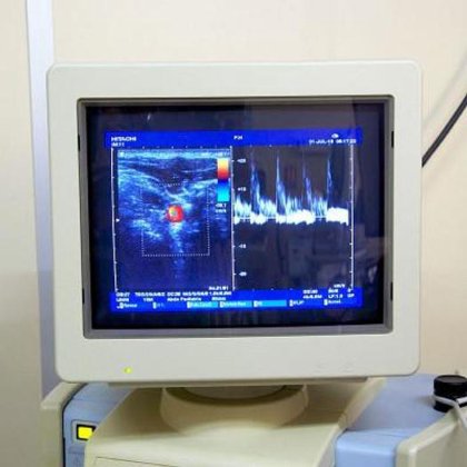 日立 EUB-6500 小児心エコー計