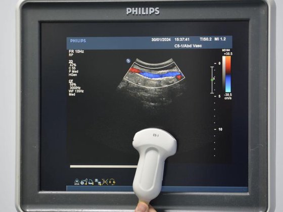 PHILIPS IU22