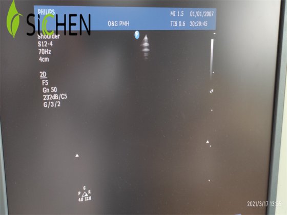 フィリップスの医学のイメージ投射装置 S12-4 IU22 のセクターの配列の超音波トランスデューサー/調査