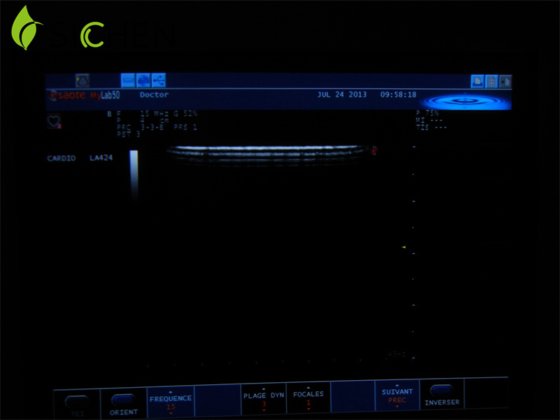 バイオサウンド医療施設LA424キャビティ内超音波トランスデューサ/プローブ