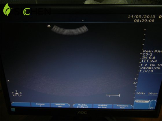 フィリップス メディカル イメージング デバイス クリアビュー