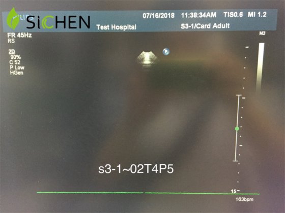 フィリップス IU22 S3-1 のセクターの配列の超音波トランスデューサー/調査