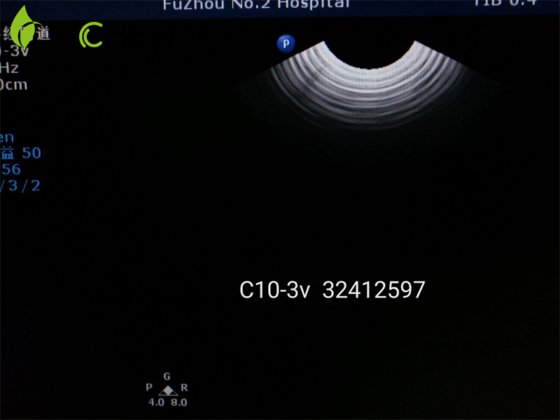 フィリップス医療画像機器 C10-3V 膣内超音波トランスデューサー/プローブ