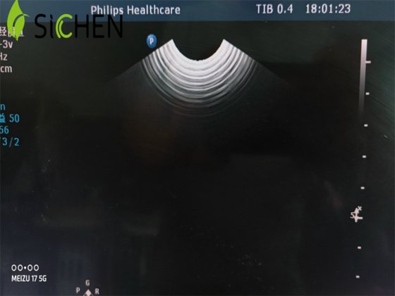 フィリップス医療画像機器 C10-3V 膣内超音波トランスデューサー/プローブ