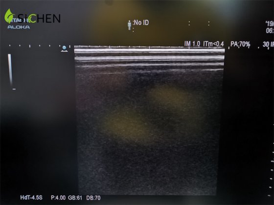 日立 L441 リニアアレイ超音波トランスデューサ/プローブ