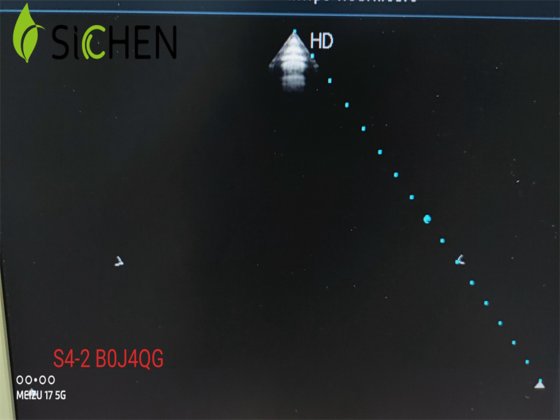 フィリップス医用画像装置S4-2体積湾曲超音波トランスデューサ/プローブ