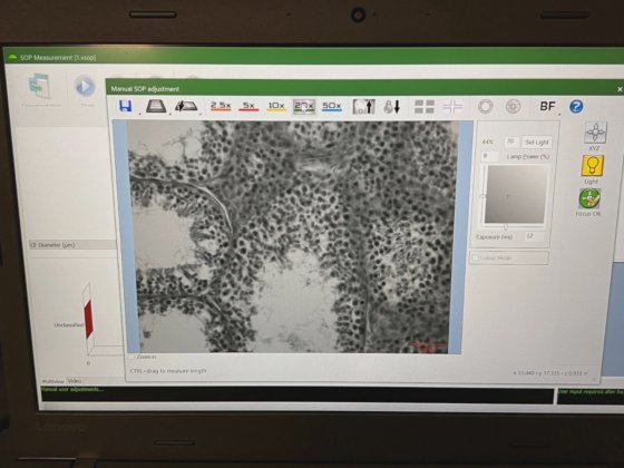 Malvern Morphologi 4 Particle Size