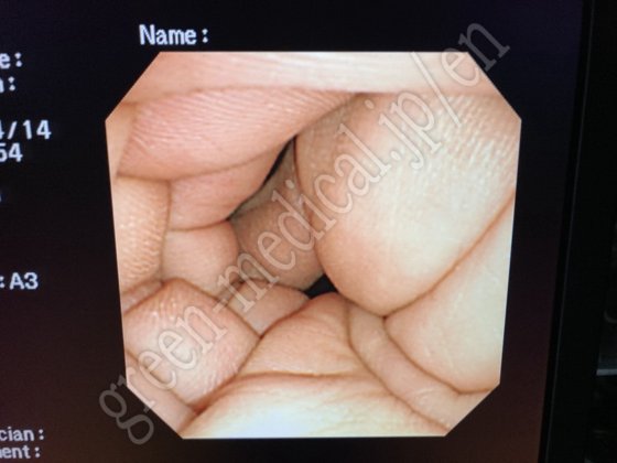 OLYMPUS ．GIF-XP260N