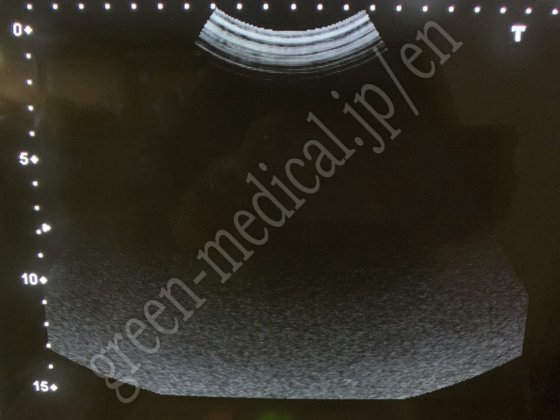 东芝 SSA-550A Nemio30