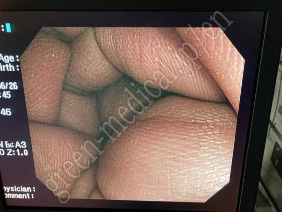 奥林巴斯 OEV191H