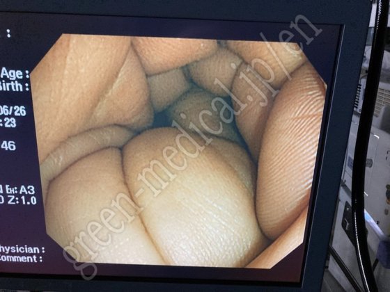 奥林巴斯 OEV191H