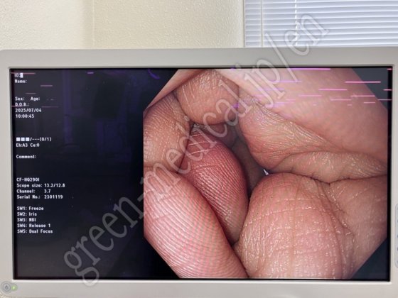 奥林巴斯 CLV-290