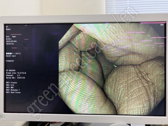 奥林巴斯 CLV-290