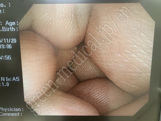 奥林巴斯 CF-Q260AI