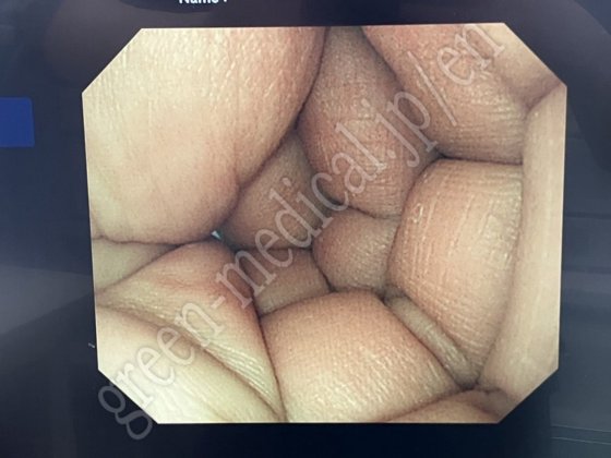 奥林巴斯 OEV191H