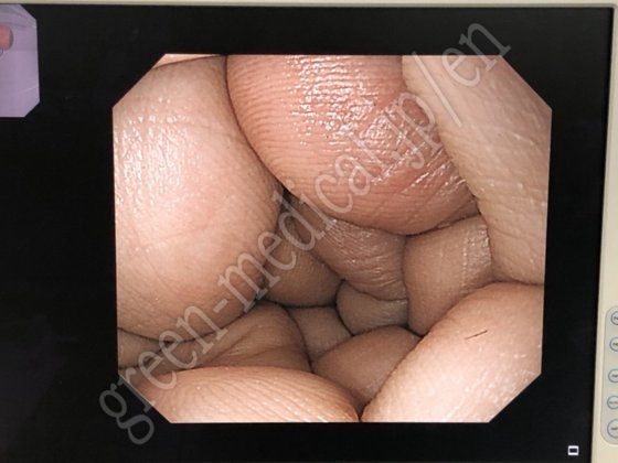 奥林巴斯 CLV-290SL