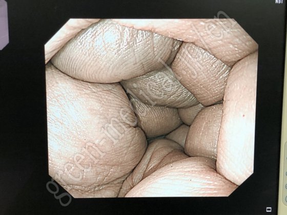 奥林巴斯 CLV-290SL