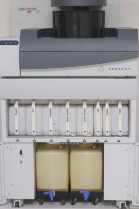 ベンタナ ベンチマーク ディスカバリー XT