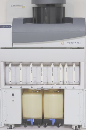 ベンタナ ディスカバリー XT