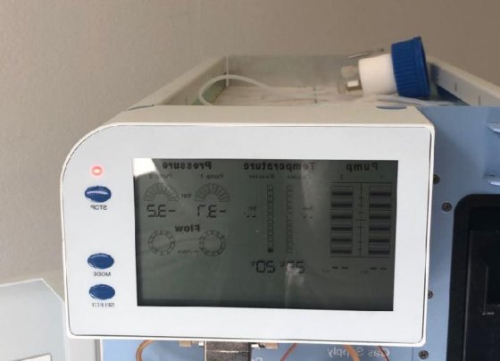 Pinnacle PCX 系统用于柱后衍生化