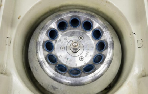 エッペンドルフ 5410 遠心分離機