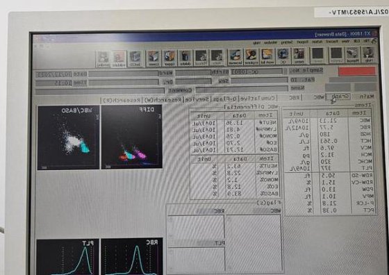 Sysmex XT-1800i 自動血液分析装置Sysmex