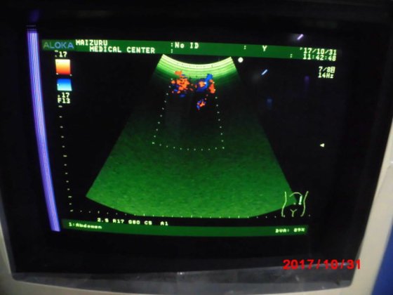 HITACHI Prosound α5