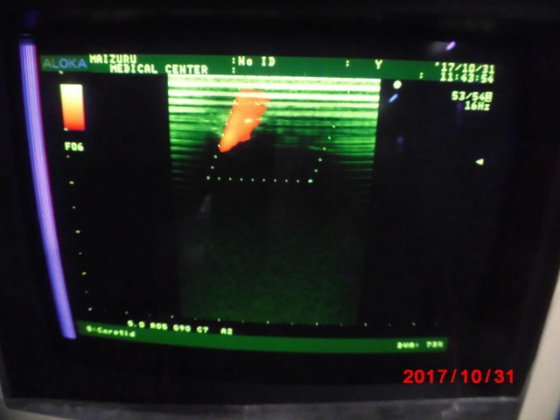 HITACHI Prosound α5