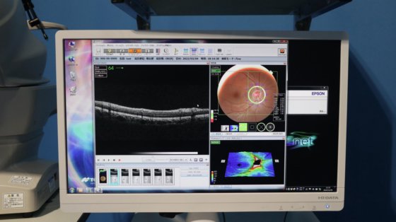 2015 TOPCON 3D OCT-1 Maestro