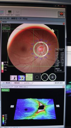 2015 TOPCON 3D OCT-1 Maestro
