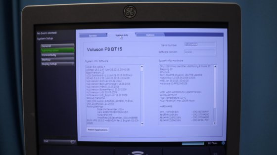 2015 GE Voluson P8