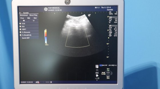 2012 GE LOGIQ S7 Expert