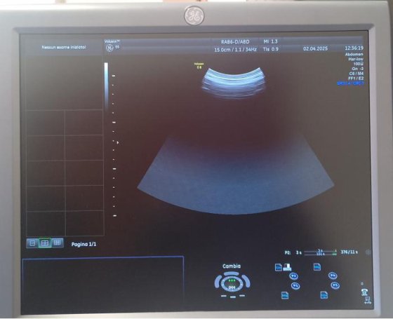 2015年GE Voluson E6翻新E6超声波仪