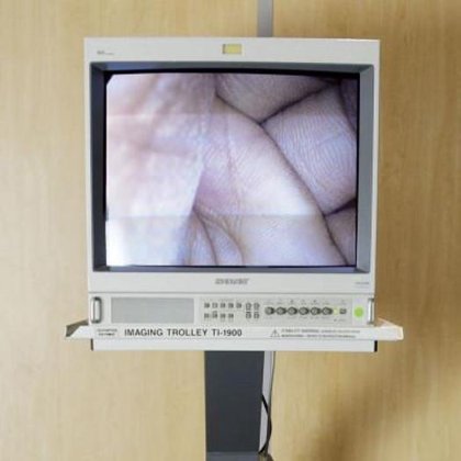 オリンパス内視鏡セット