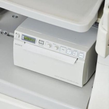 带 4 个探头的飞利浦 3D/4D 超声波