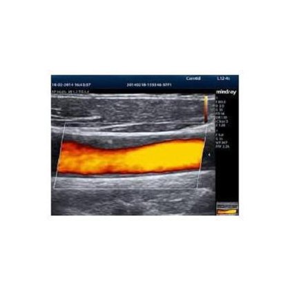 迈瑞M7便携式超声仪(2013)