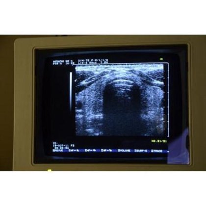 日立オデッシー エコードップラー超音波