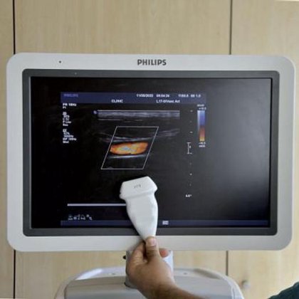 飞利浦 IU22 血管超声仪